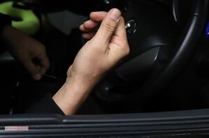 カイヤが運転する車に飛び乗ったが、加速されて振り落とされたときにできた傷を見せる麻世