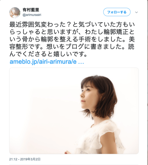 ツイッターで整形手術を伝える。18日現在約4万8千件の「いいね！」が