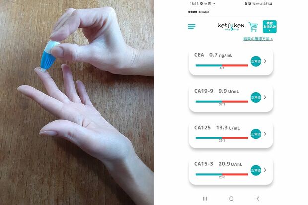 ketsuken女性向けがん検査