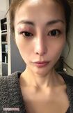 発症したときの痛々しいようす 写真提供/熊切あさ美
