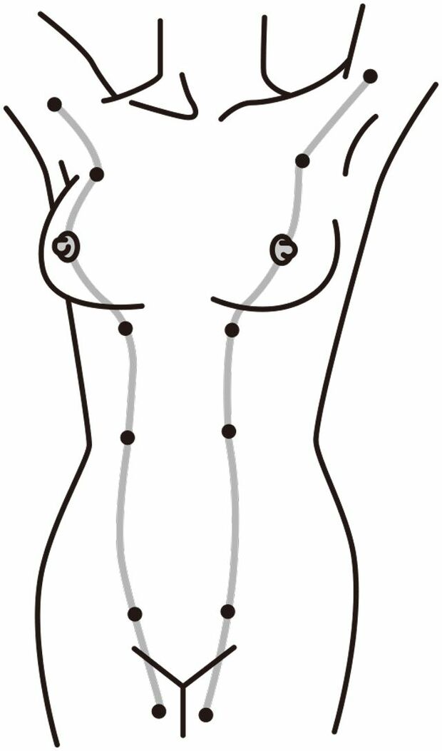 乳腺は両ワキから乳首を通って内股の方向へと流れている。そのライン上にある黒い点の部分に副乳ができやすい　イラスト／スヤマミヅホ
