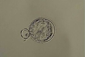 女性のキャリアプランにかかわる出産にも多様性が求められている（写真はイメージです）