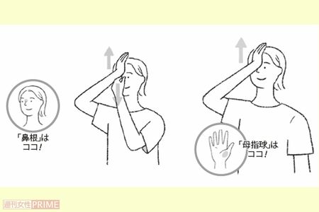 眼窩上げ イラスト/高橋マサエ