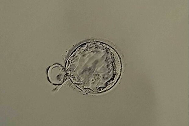 女性のキャリアプランにかかわる出産にも多様性が求められている（写真はイメージです）