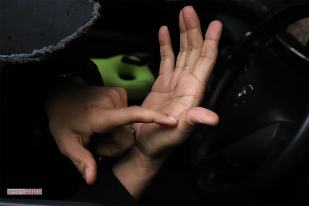 カイヤが運転する車に飛び乗ったが、加速されて振り落とされたときにできた傷を見せる麻世