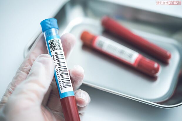 血液型による発症リクスや重症化リスクの違いが、複数の研究報告で指摘されている ※写真はイメージです