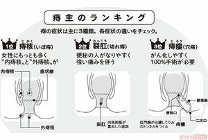 痔主のランキング　イラスト／上田惣子