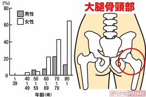 年齢別骨粗しょう症の割合　出典:骨粗しょう症の予防と治療ガイドラインより