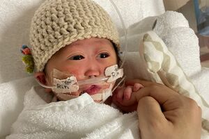 生まれたばかりのリンちゃん。脳が左右に分かれておらず、うまく生きていけないといわれた