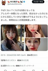 7月9日、唇の異変を訴えた中川翔子（本人Xより）