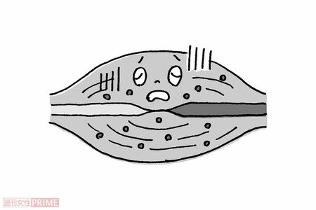 ダメージを受けたことでさらに血行不良に（イラスト／伊藤和人）