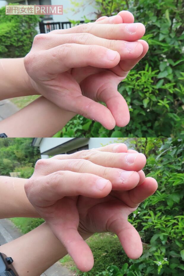 飼い主の男性に大きなエサを丸のみするメカニズムを尋ねると、（上）口を開けたヘビを両手で模し、（下）下アゴ部分を左右に広げて体内に取り込むと教えてくれた