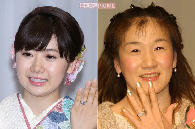 婚約指輪を披露する福原愛（左・2016年）と谷亮子（右・2003年）