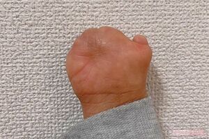 右手の写真。神経も通っていて、手のひらには手相もあると教えてくれた