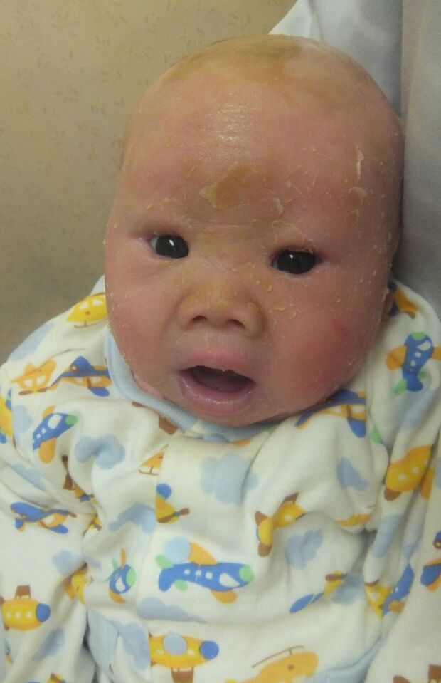 退院後まもない賀久くん。笑顔の裏に闘いの日々があった