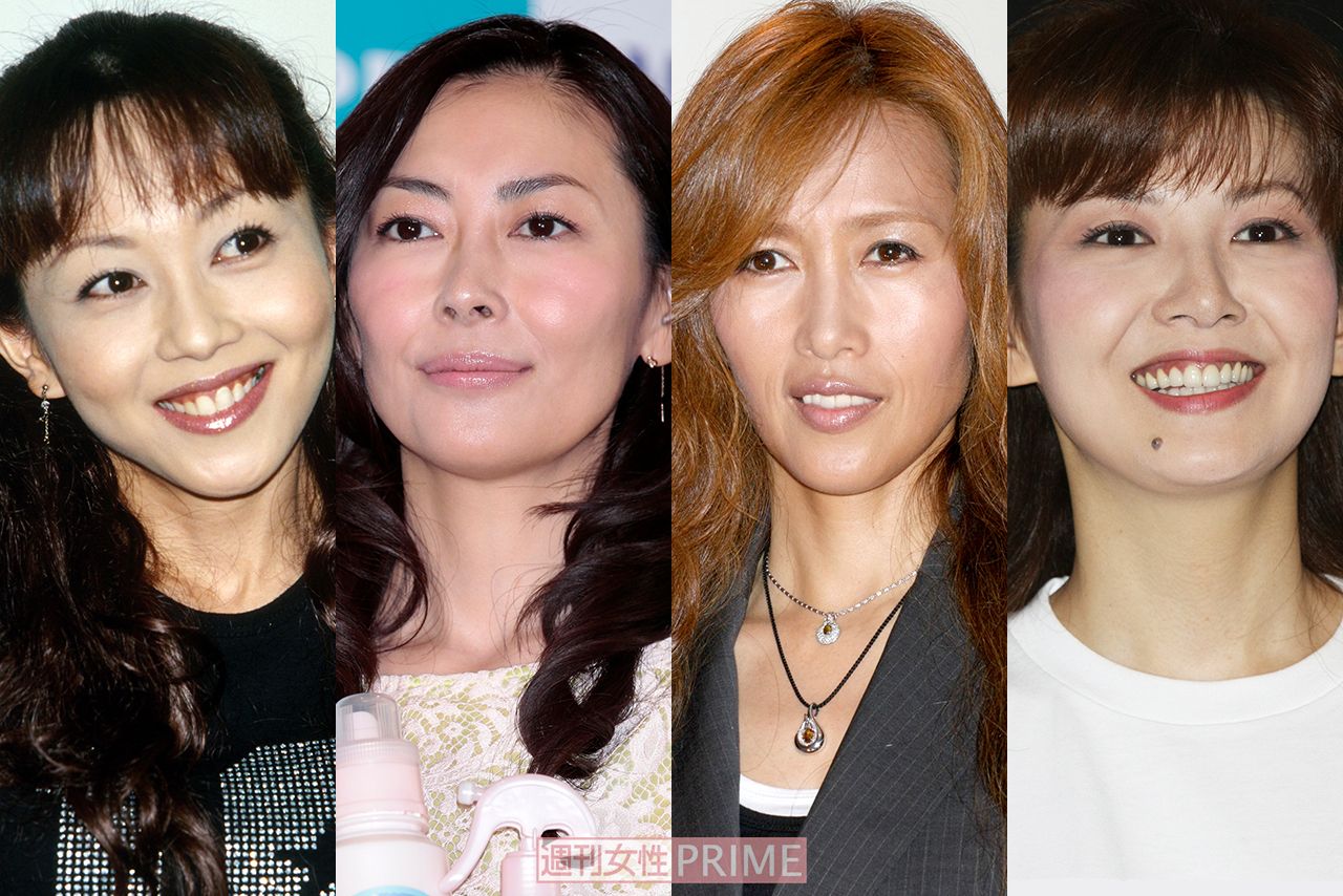 中山美穂・浅香唯・工藤静香・南野陽子」昭和後期アイドルを美容整形