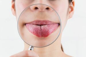 自分の舌、見てますか?