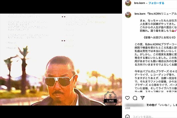 「なっちゃったもんは仕方ない」乳がんを告白したブラザー・コーン（公式インスタグラムより）