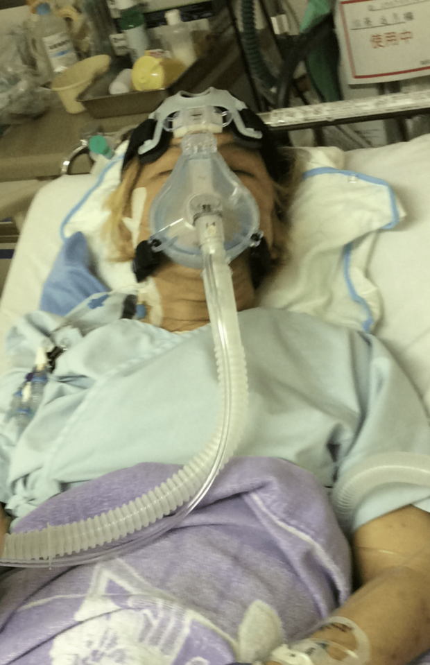 2017年の心臓バイパス手術直後の南部虎弾さん