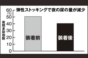 夜間排尿回数2回以上で、足にむくみのある23人に医療用弾性ストッキングをはいてもらったところ、24時間尿量のうち夜間尿量が占める割合を示す「夜間多尿指数」が減少し、量にして平均約300ml減った。（データ提供　宮津武田病院院長　曽根淳史先生）