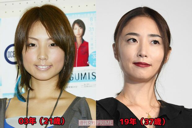 長澤まさみは あっても 可愛い Megumiは なくして 若返り 老けて見えるor見えない ほうれい線 の差とは 3ページ目 週刊女性 Prime