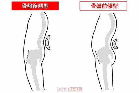 これが「バナナ腰」（イラスト／二階堂ちはる）