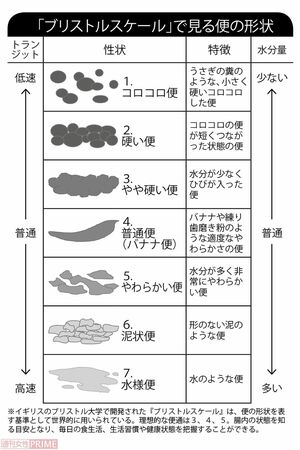 「ブルリストルスケール」で見る便の形状
