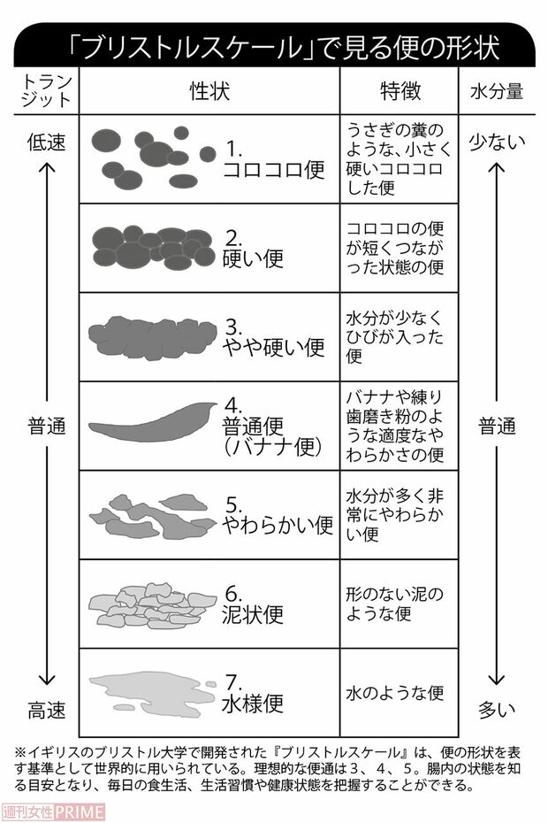 「ブルリストルスケール」で見る便の形状