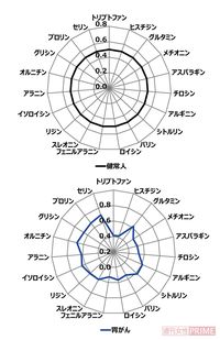 これが血中アミノ酸バランス！
上が健常人。下が胃がん患者のレーダーチャート
