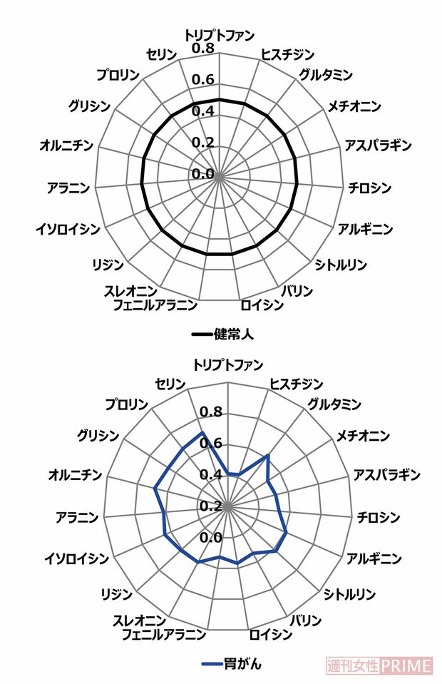これが血中アミノ酸バランス！
上が健常人。下が胃がん患者のレーダーチャート