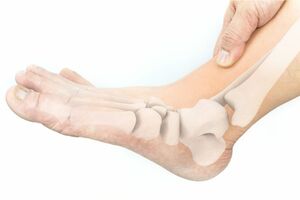 靴底の減り方でわかる身体の不調（※画像はイメージです）