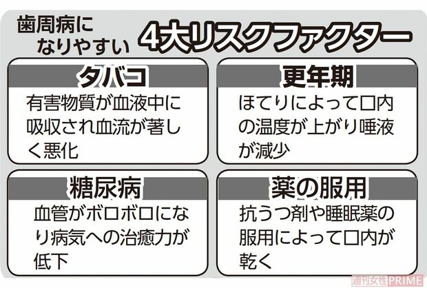歯周病になりやすい4大リスクファクター