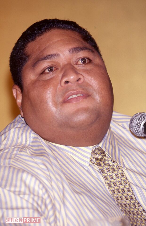 マゲを切り引退会見をする、ハワイ出身の小錦