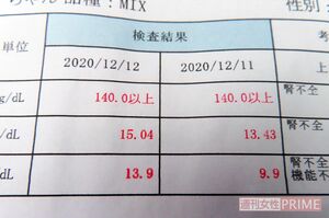 げんの腎臓の数値は「140.0以上」と赤字で測定上限値の突破が示されて