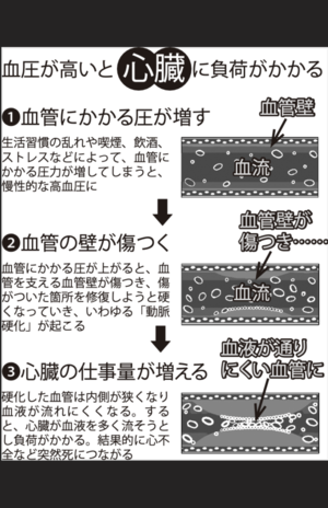 血圧が高いと心臓に負荷がかかる