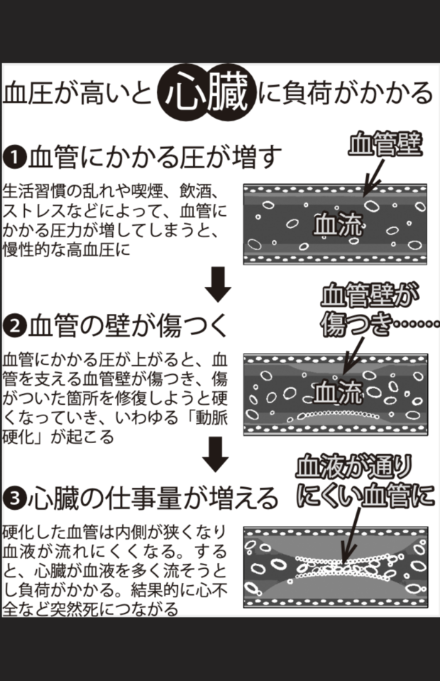 血圧が高いと心臓に負荷がかかる
