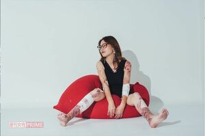 Youtubeチャンネル「こむぎのキロク」で表皮水疱症の症状を発信しているこむぎさん提供：栗田一歩