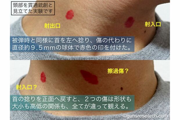 首をひねると右前頸部と喉仏の下部が同じ高さ（上）になる（画像は高倉総一郎氏提供）