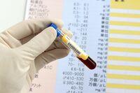 「血液型別かかりやすい病気」には医学的根拠があった!医師が解説、A型はがん、B型は肺炎、O型は胃潰瘍、A…