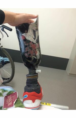 事故から4か月後、森野徹容疑者が作った和柄デザインの義足（本人Facebookより）