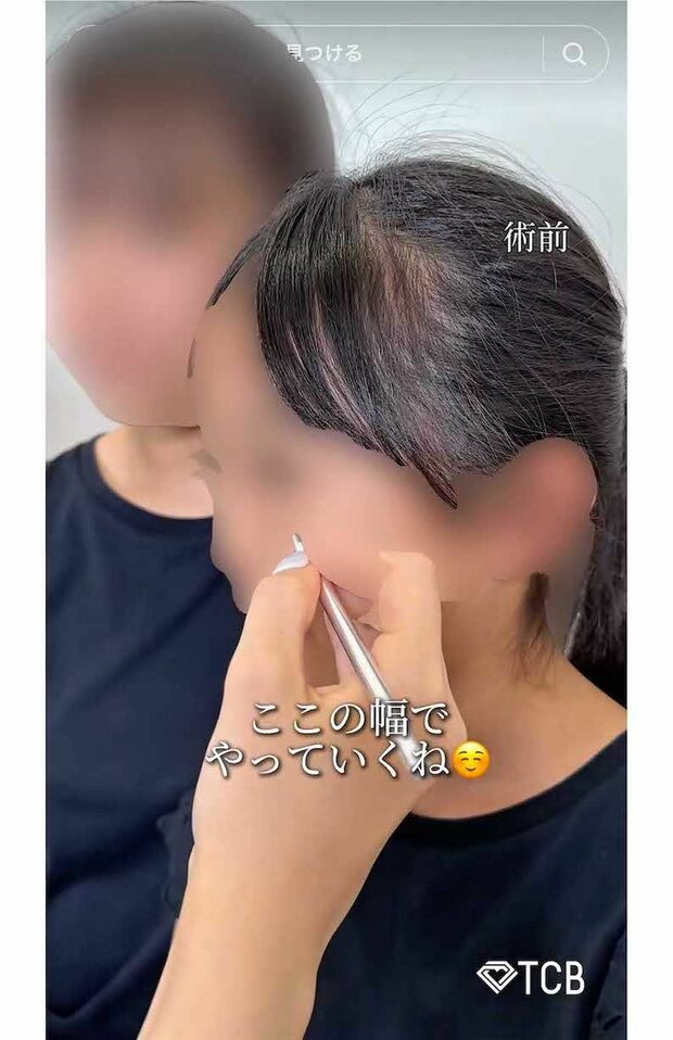 夏休み中の10歳の女子小学生が二重整形を受ける様子を動画投稿したTCB東京中央美容外科・新宿東口院の医師(TikTokより)