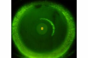 表層角膜炎(写真提供/糸井素純)