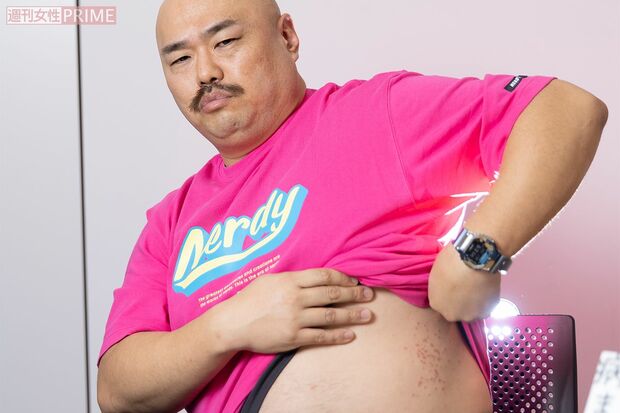 リチと同棲するようになってからじんましんができたというクロちゃん