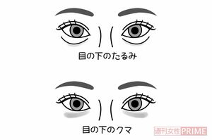 目の下の異変 イラスト/石崎伸子