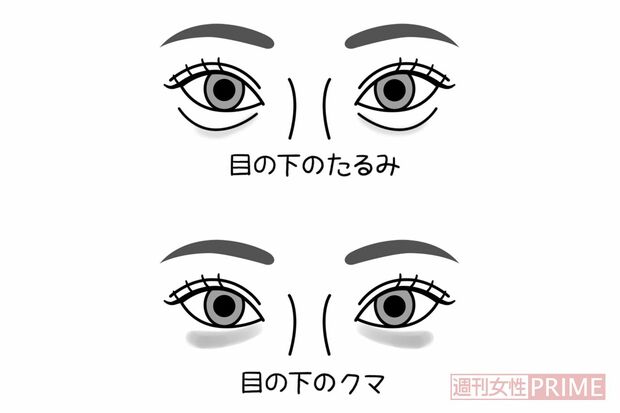 目の下の異変　イラスト／石崎伸子