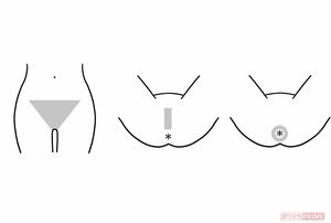 デリケートゾーンの脱毛は3種類。一般にVIO脱毛と呼ばれ、Vはビキニライン、Iは陰部の両側、Oは肛門まわりのゾーンを指す。　イラスト／上田惣子