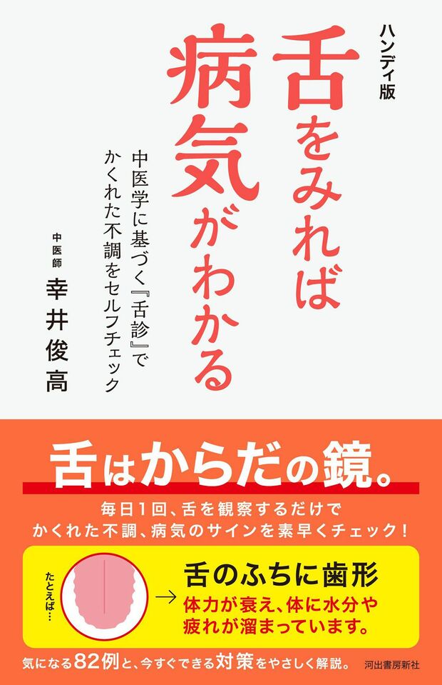 『舌をみれば病気がわかる』（幸井俊高著）　※記事中の画像をクリックするとアマゾンの商品紹介ページにジャンプします