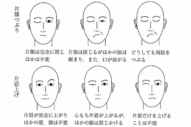 図3：ウインクと片眉上げの得手不得手の分類（香原志勢『顔と表情の人間学』より）