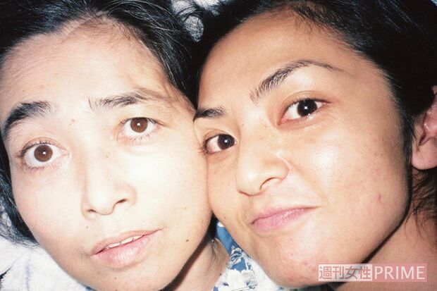 がんが見つかり、在宅医療での広美さんの介護と仕事を両立させていた亞聖さん。小野先生は、彼女を中心にきょうだいが団結していることで、在宅医療にゴーサインを出したという