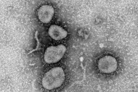 新型コロナウイルスの電子顕微鏡写真（国立感染症研究所より）